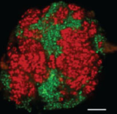 Ethane50-Kultur Candidatus Ethanoperedens - Bild © MARUM, open access